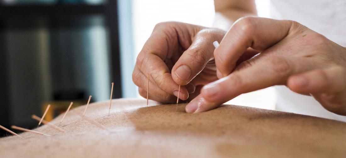 Receiving acupuncture treatment